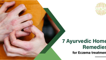 7 Ayurvedic Home Remedies for Eczema Treatment