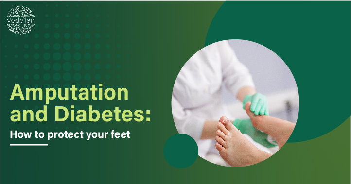 Amputation and Diabetes: How to Protect your Feet