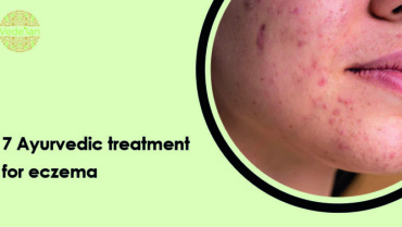 7 Ayurvedic Treatment For Eczema